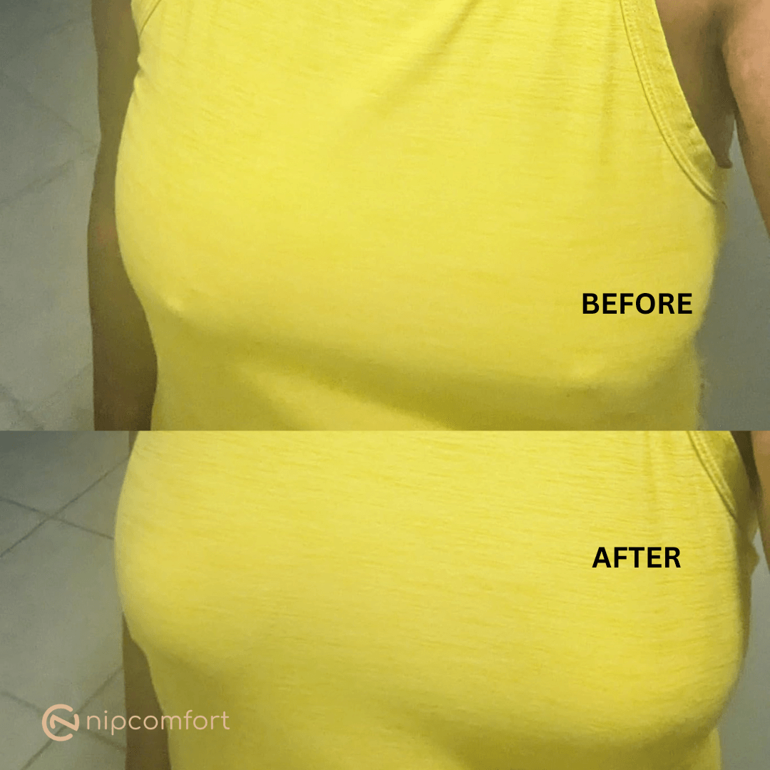 NipComfort - Non Adhesive Nip Covers