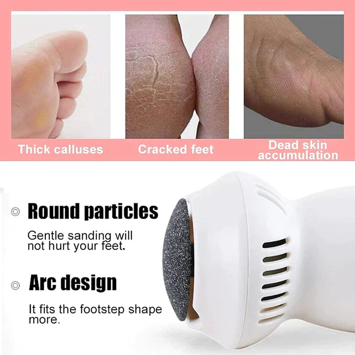 PediVac™ | Electric Callus Remover With Vacuum